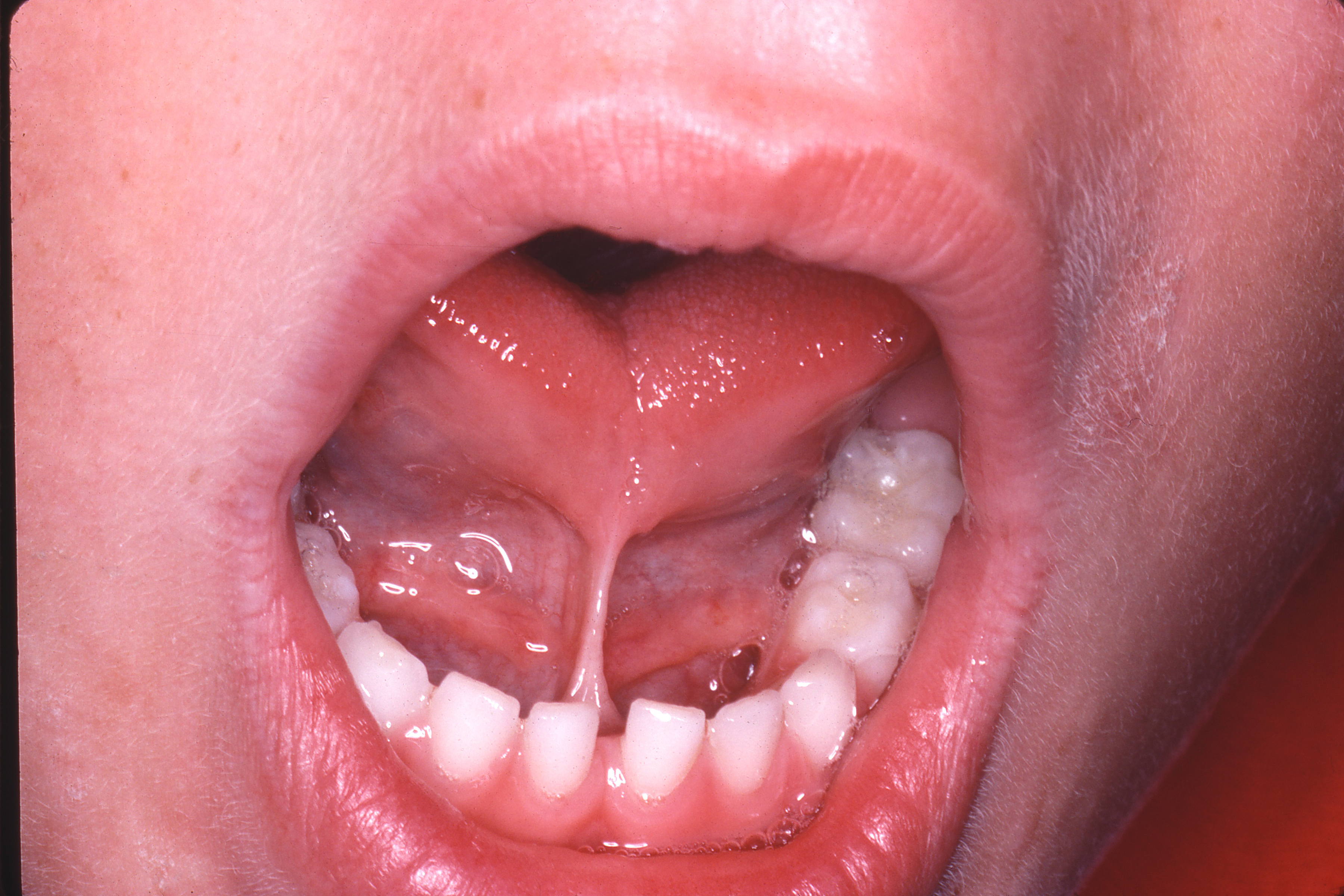 Tongue Nipples 38